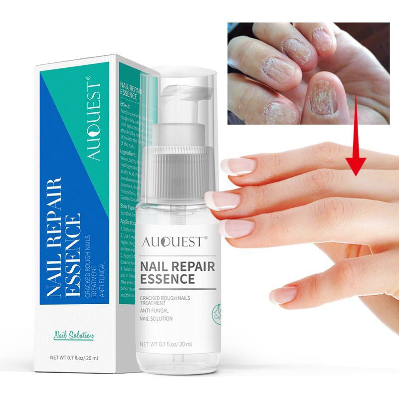 Home Bottle Anti-Barb Nail Repair Lotion