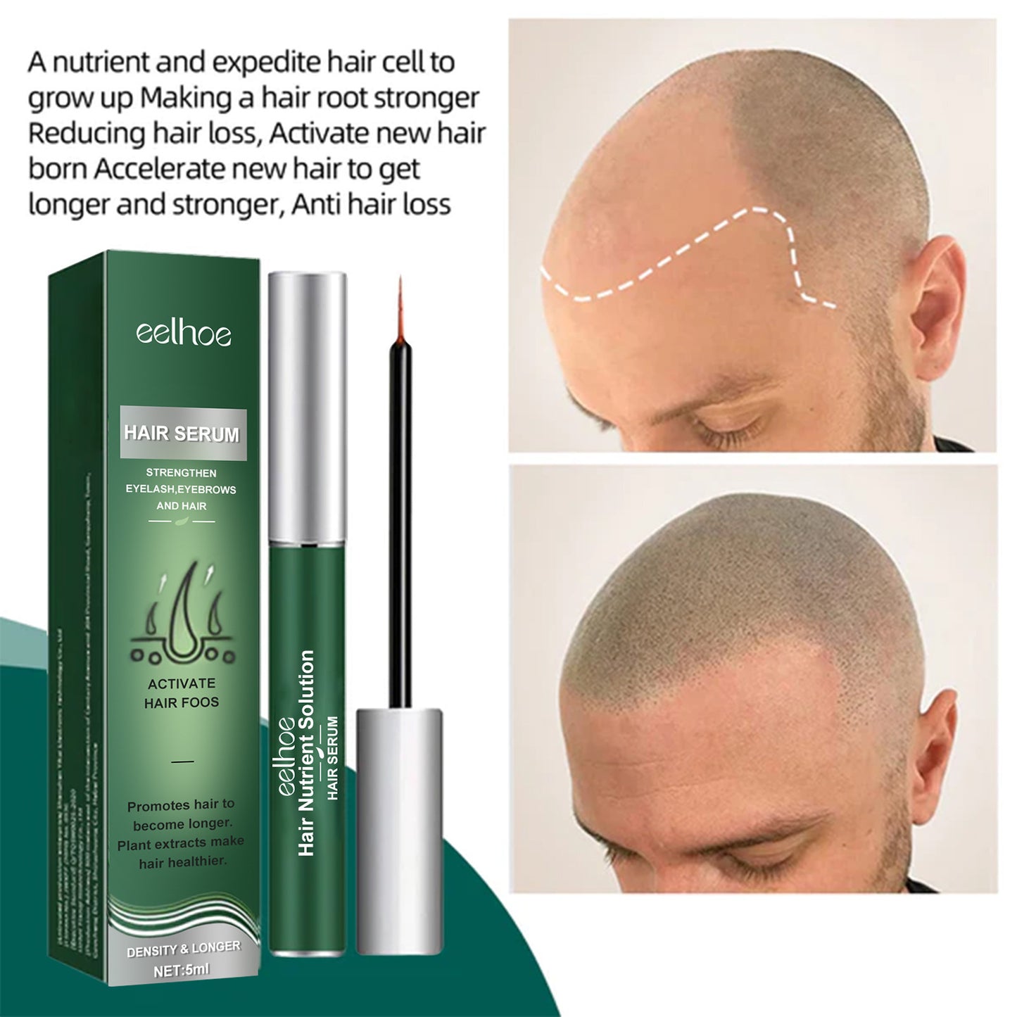 Anti-hair Loss Mild Hair Root Strong Plant Care Prime