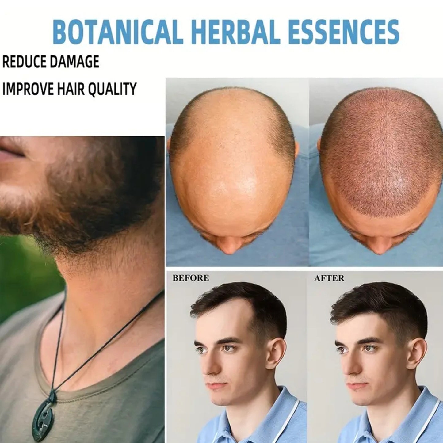 Anti-hair Loss And Hair Fixation Nourish Thick Care Cream