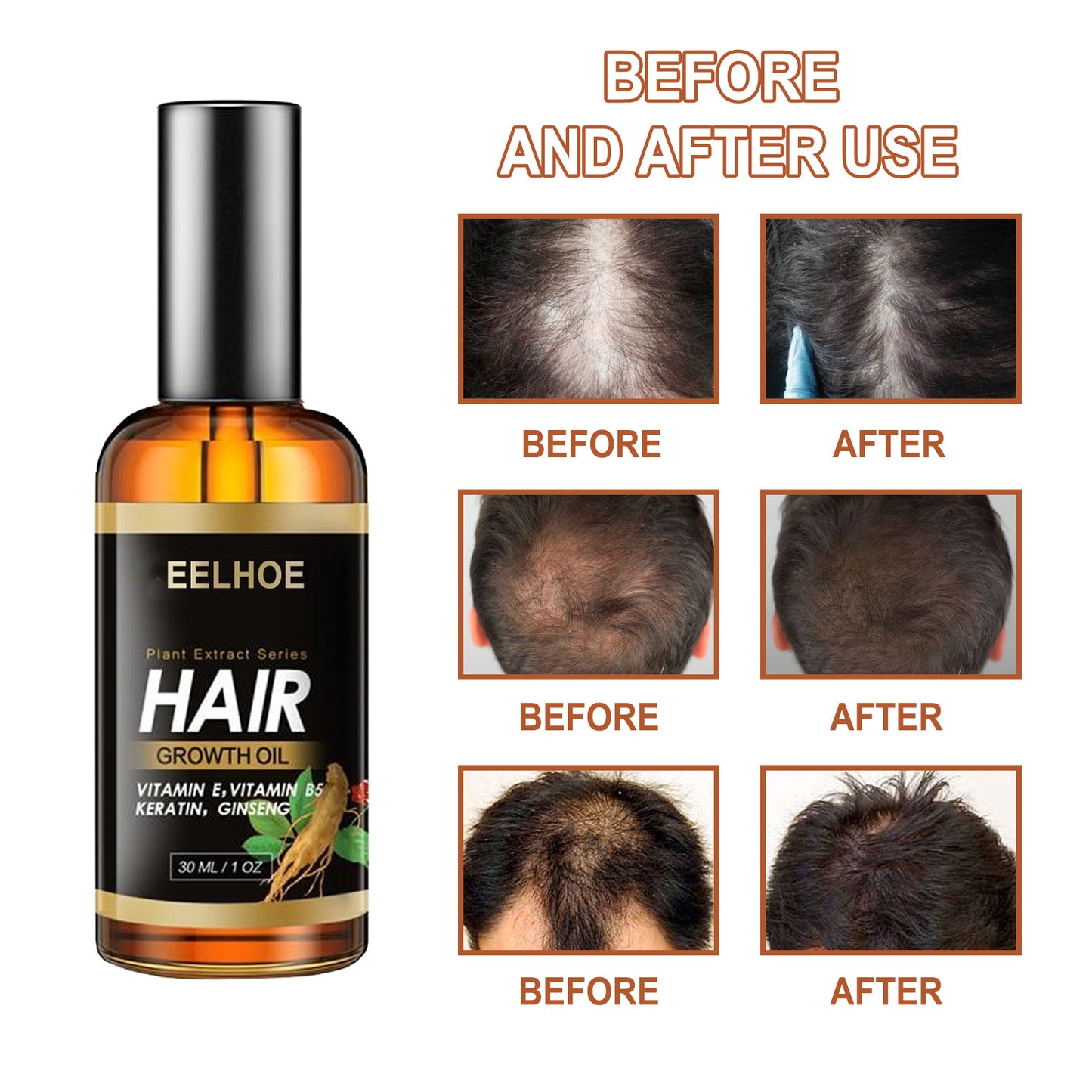 Hair Care Essential Oil Hair Strong Hair Reduce Hair Loss Essential Oil