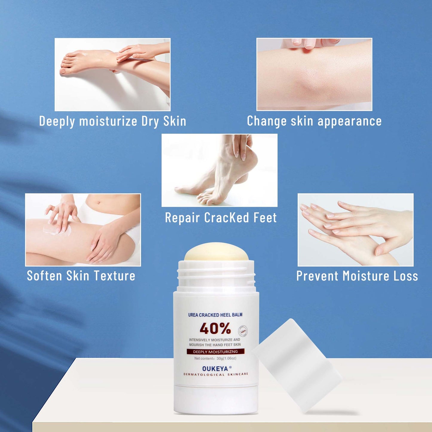 Cracked Skin Repair Cream