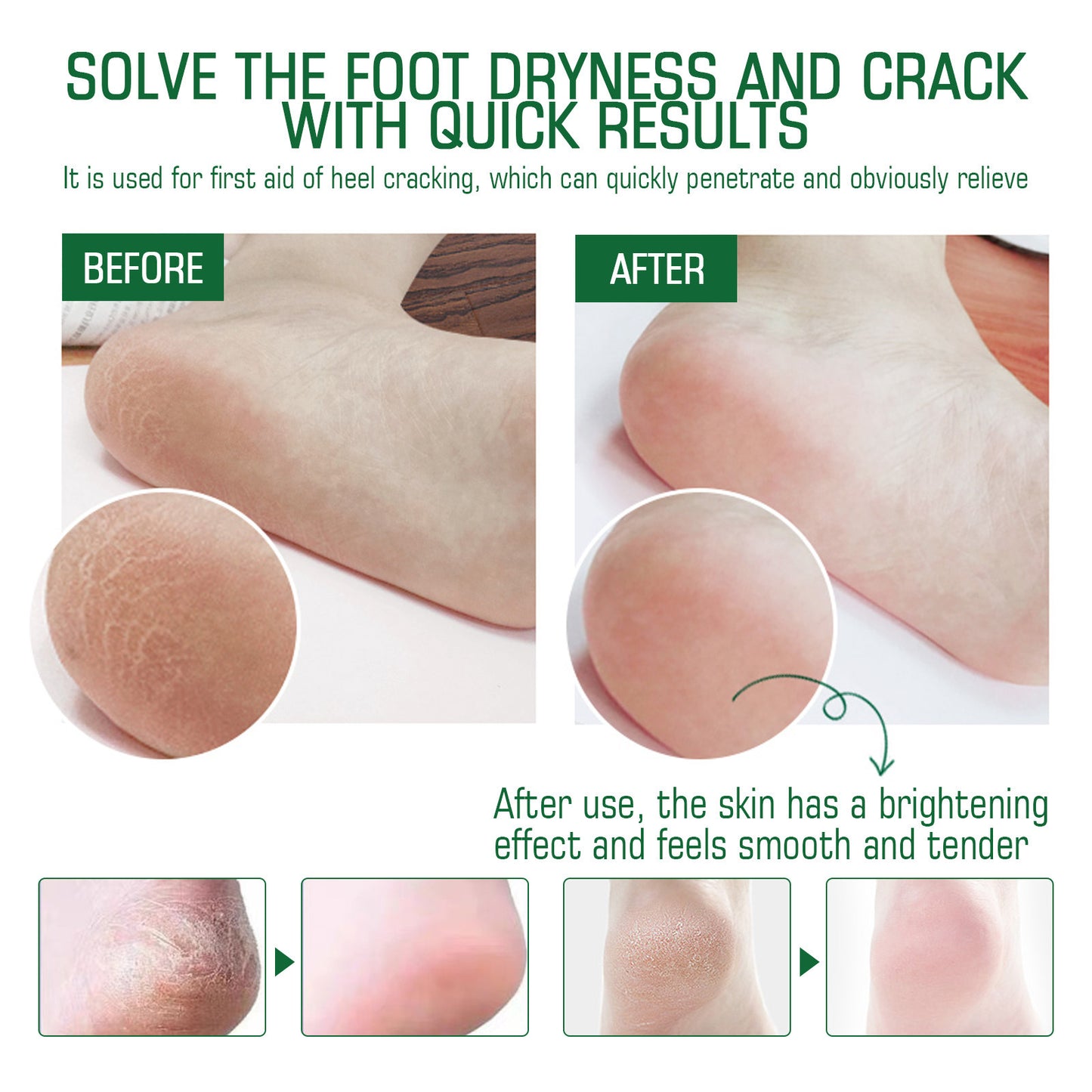 Repair Heel Leather Anti-cracking Foot Cream