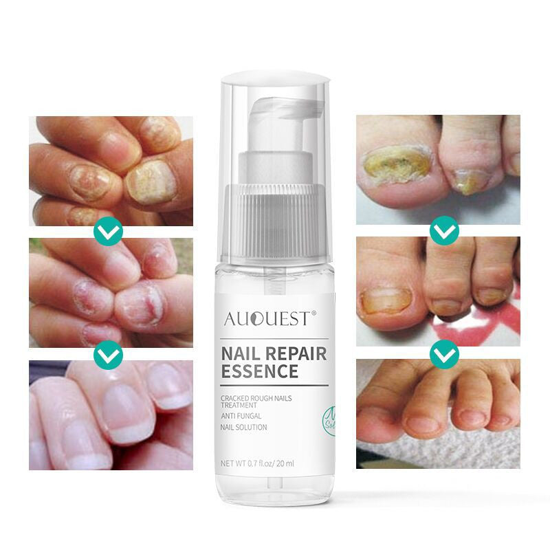 Home Bottle Anti-Barb Nail Repair Lotion