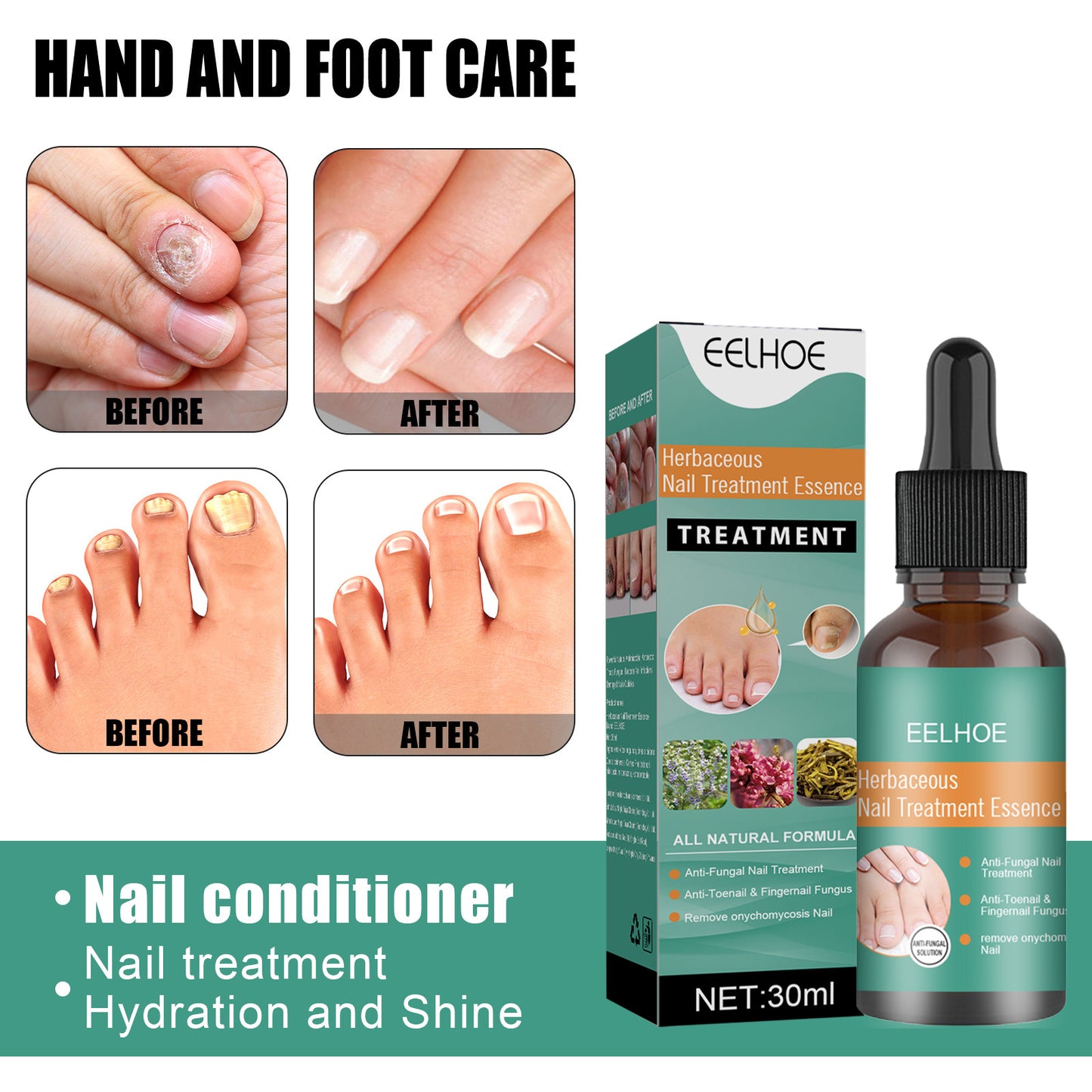 Home Bottled Nail Fungus Repair Lotion