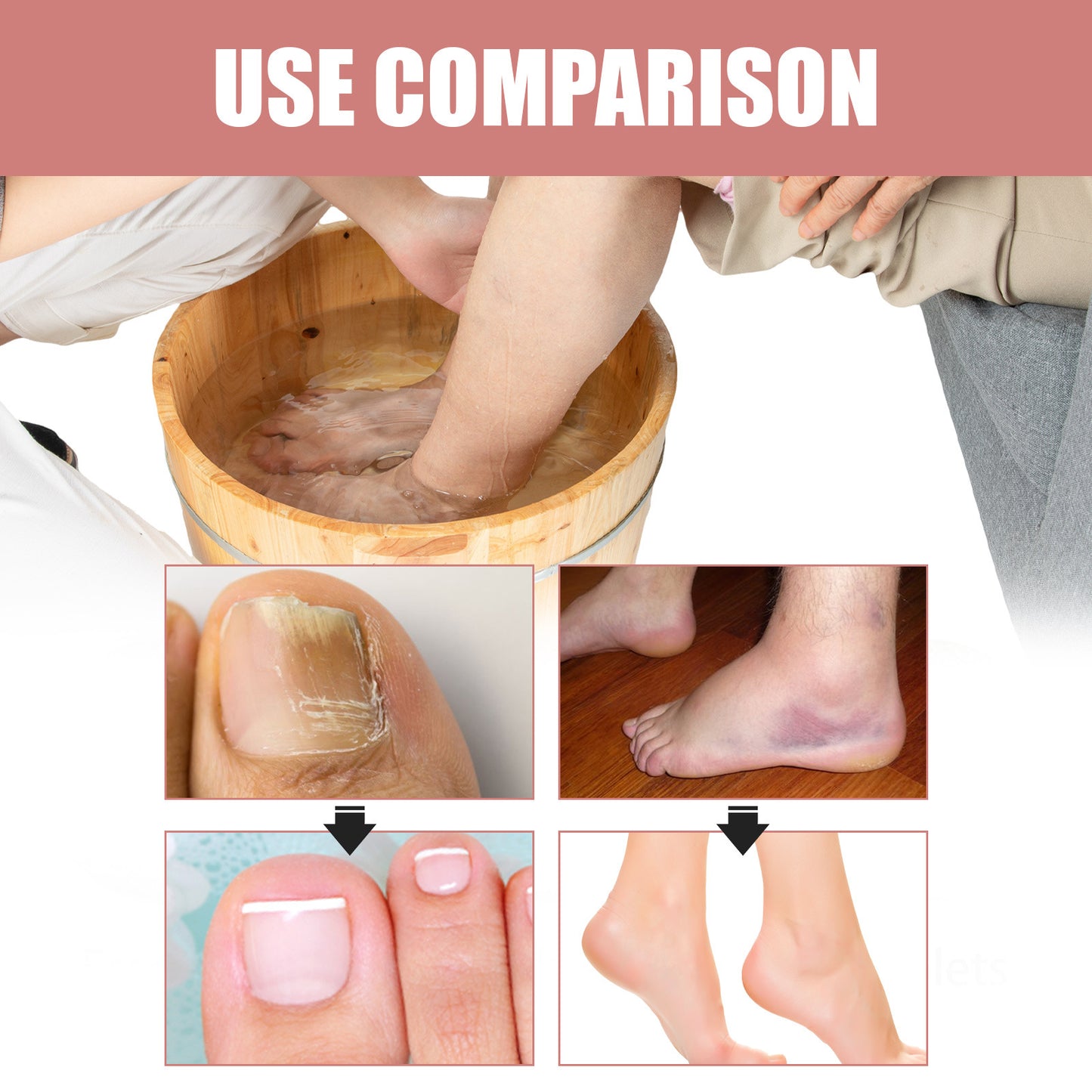 Calluses Relieve Soreness And Swelling Foot Bath Tablets