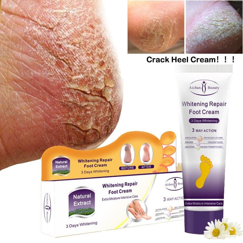 Cracked Heel Repair Cream