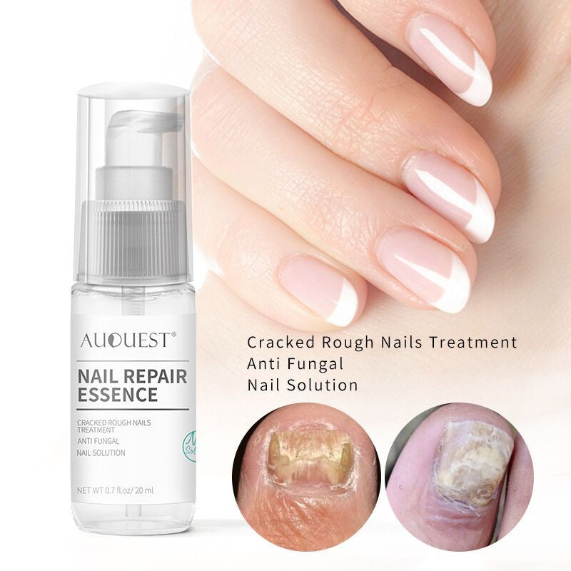 Home Bottle Anti-Barb Nail Repair Lotion