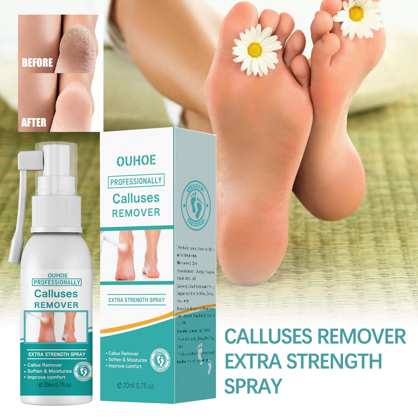 Calluses Relieve Foot Bath Treatment