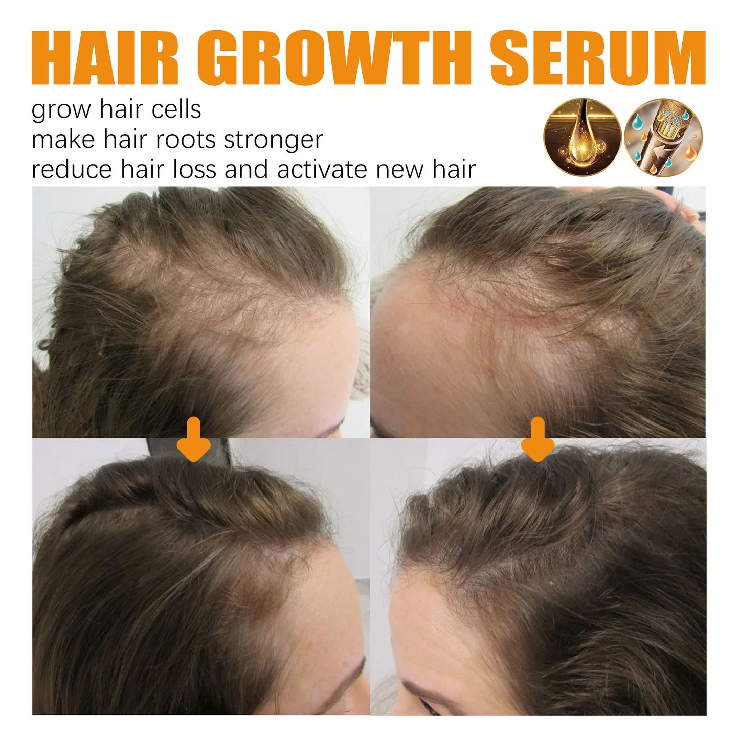 Biotin Hair Dense Hair Spray Repair Hair Nourishing Hair Care Hair Fixing Strong And Tough Anti-hair Loss Root Spray